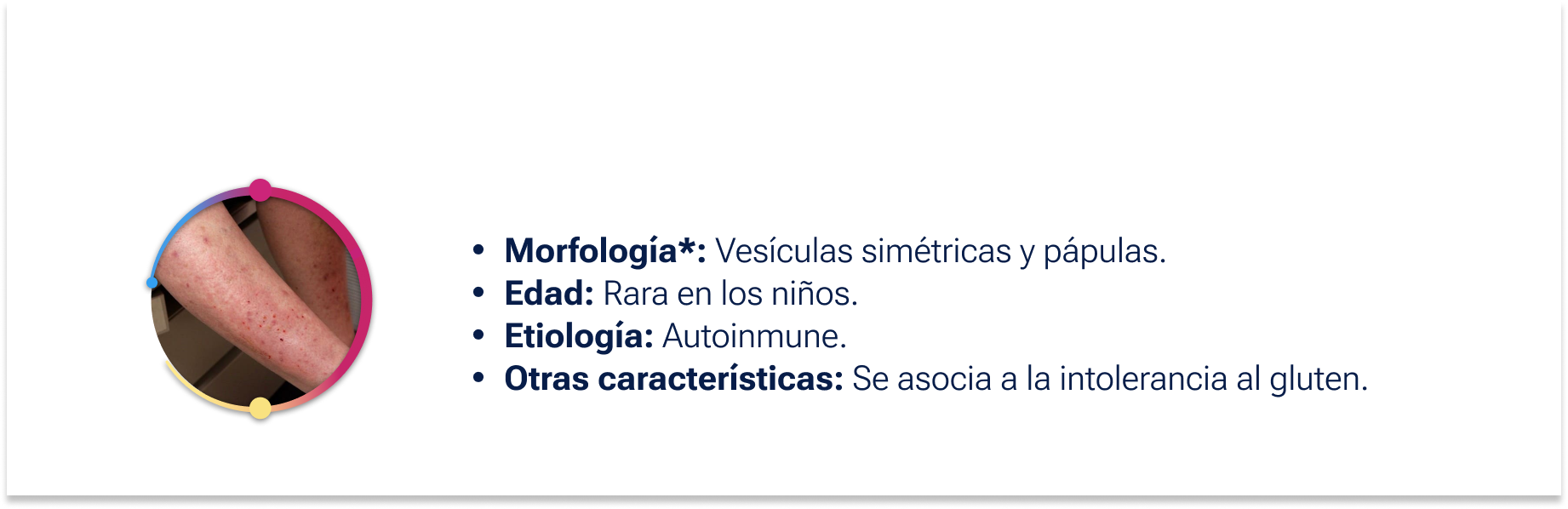 Dermatitis herpetiforme